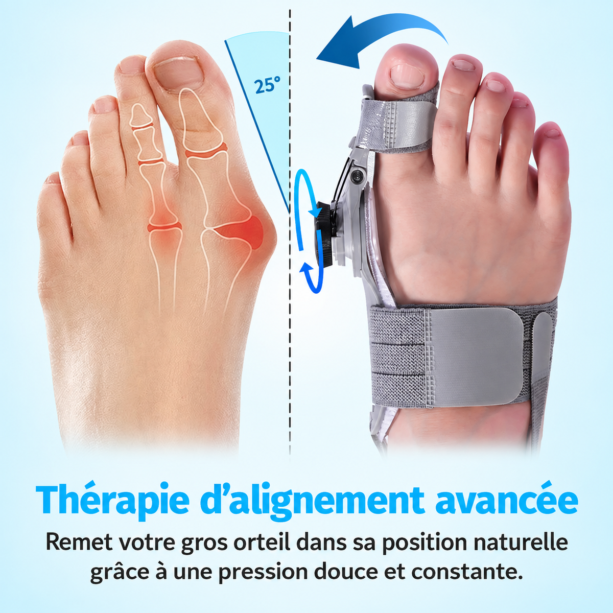 Orthevia™ Alignement